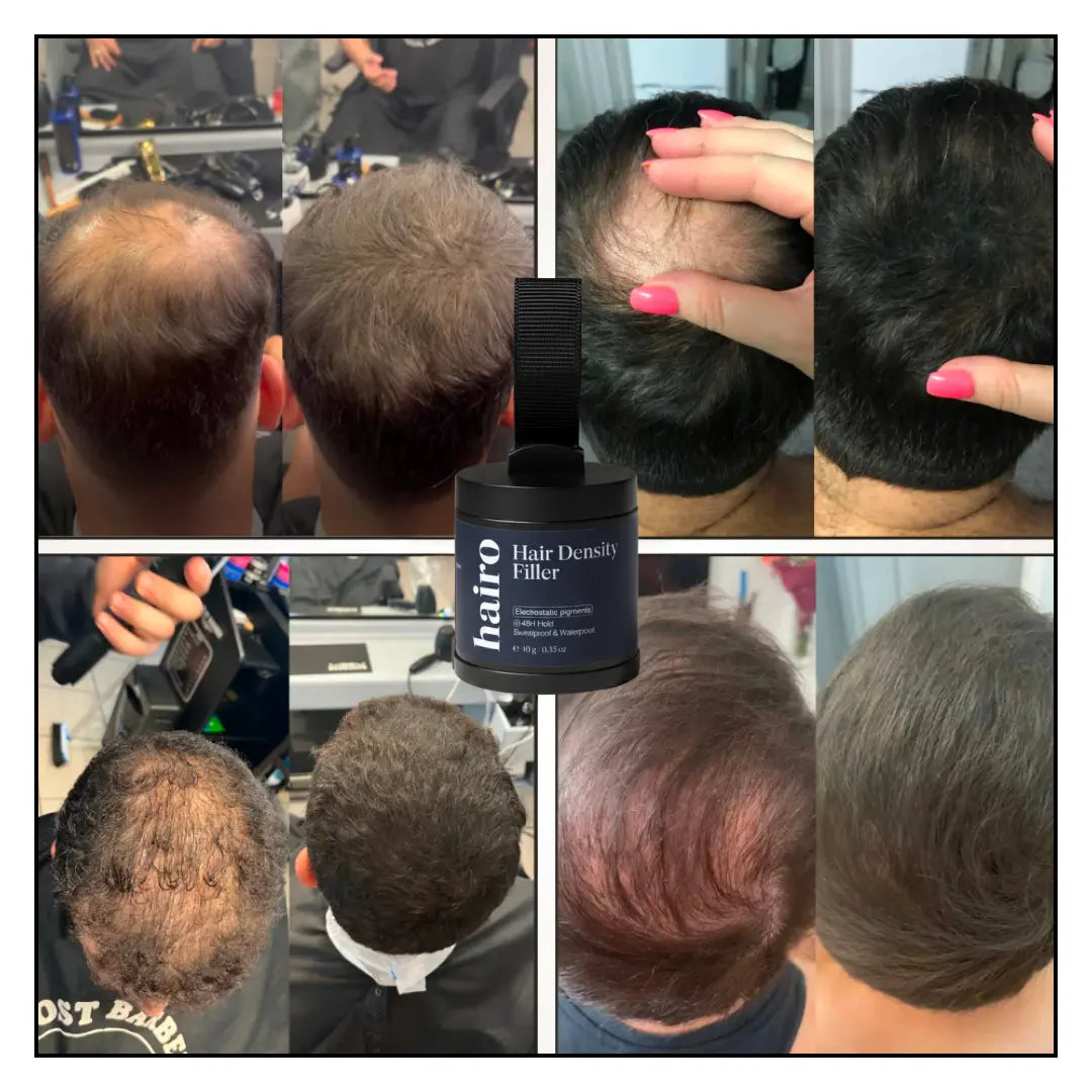 Cheveux Clairsemés