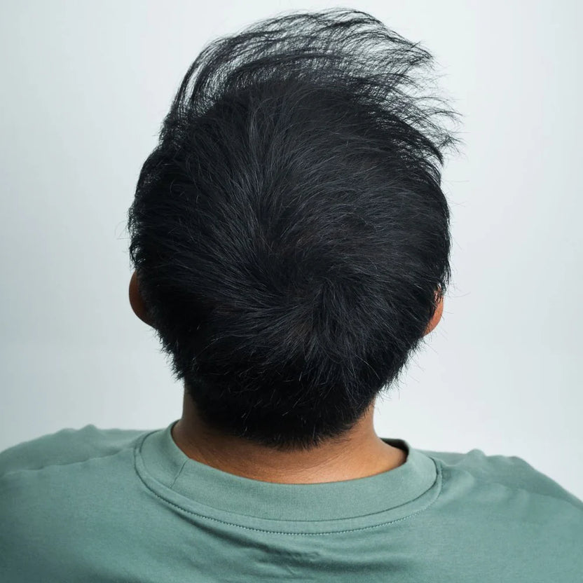 Beard après