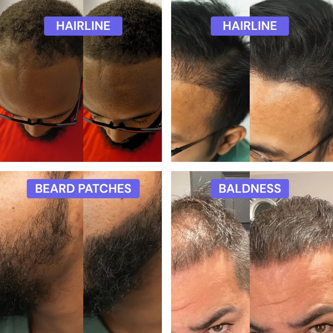HAIRO